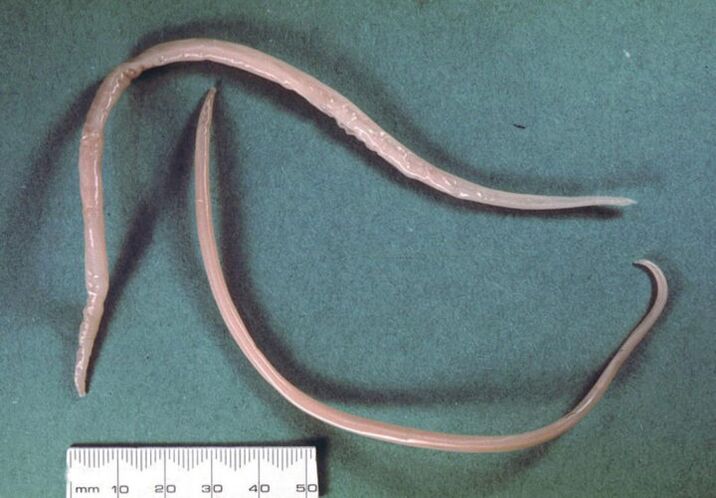 Intestinal worm