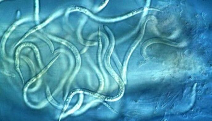 How do nematode parasites look in the human body