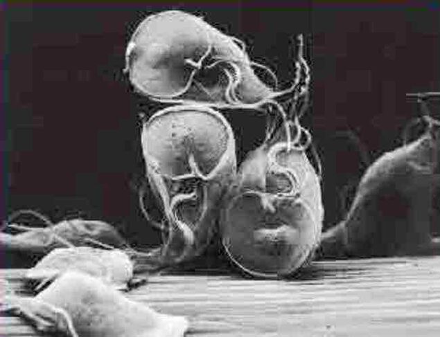 giardia protozoan parasite